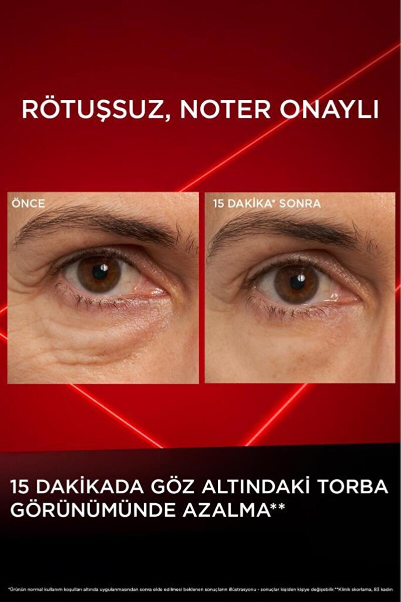 Revitalift Lazer Eyebag Instant Eraser Göz Altı Torba Görünümüne Karşı Etkili Göz Kremi 15ml 2. görsel
